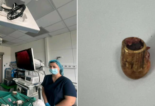 Kirurgët në QKUK bëjnë mrekulli: Hiqet plumbi nga mushkëria e 28-vjeçarit